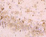 IGF2BP3 Antibody in Immunohistochemistry (Paraffin) (IHC (P))