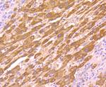 AKR1C1 Polyclonal Antibody