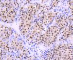 OGG1 Polyclonal Antibody