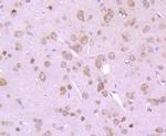 eIF4E Antibody in Immunohistochemistry (Paraffin) (IHC (P))