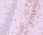 eIF4E Antibody in Immunohistochemistry (Paraffin) (IHC (P))