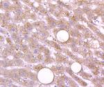 Cathepsin D Antibody in Immunohistochemistry (Paraffin) (IHC (P))