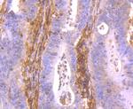 HLA-AB Polyclonal Antibody