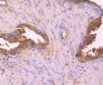HLA-AB Antibody in Immunohistochemistry (Paraffin) (IHC (P))