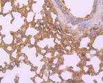 HLA-AB Antibody in Immunohistochemistry (Paraffin) (IHC (P))