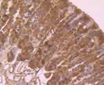 HLA-AB Antibody in Immunohistochemistry (Paraffin) (IHC (P))
