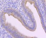 Cytokeratin 13 Polyclonal Antibody