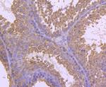 MTERFD1 Antibody in Immunohistochemistry (Paraffin) (IHC (P))