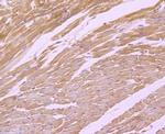 MTERFD1 Antibody in Immunohistochemistry (Paraffin) (IHC (P))