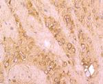 FBXL2 Antibody in Immunohistochemistry (Paraffin) (IHC (P))