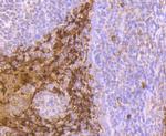 S100A8 Antibody in Immunohistochemistry (Paraffin) (IHC (P))