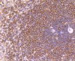 TIM-3 Antibody in Immunohistochemistry (Paraffin) (IHC (P))