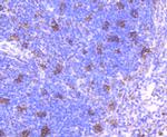 TIM-3 Antibody in Immunohistochemistry (Paraffin) (IHC (P))