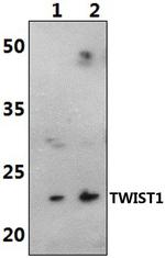 TWIST1 Polyclonal Antibody