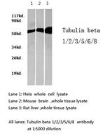 beta Tubulin Antibody in Western Blot (WB)