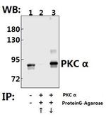 PKC alpha Antibody in Immunoprecipitation (IP)