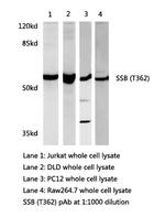 SSB Polyclonal Antibody