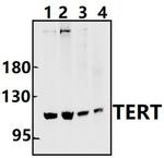 TERT Polyclonal Antibody