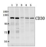 CD30 Polyclonal Antibody