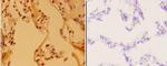 APAF1 Polyclonal Antibody