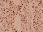 Protein APC Polyclonal Antibody