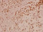 ASK1 Polyclonal Antibody