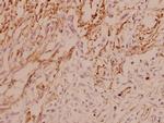 ASK1 Polyclonal Antibody