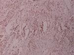 ATF2 Polyclonal Antibody