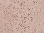 ATF4 Polyclonal Antibody