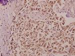 Bax Polyclonal Antibody