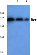 BCR Polyclonal Antibody