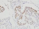 C/EBP beta Polyclonal Antibody