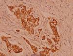gamma Catenin Polyclonal Antibody