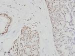 Cdc6 Polyclonal Antibody