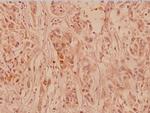 Collagen II Polyclonal Antibody