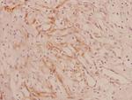 COL4A1 Polyclonal Antibody