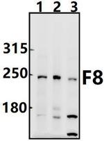 Factor VIII Polyclonal Antibody