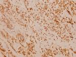 FANCD2 Polyclonal Antibody