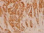 FAP Polyclonal Antibody