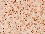 CHOP Polyclonal Antibody
