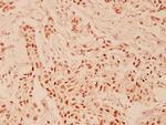 HDAC6 Polyclonal Antibody