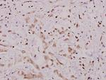 IKK alpha Polyclonal Antibody