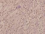 CSF2RB Polyclonal Antibody