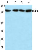 ITGB5 Polyclonal Antibody