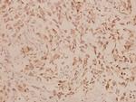 Involucrin Polyclonal Antibody
