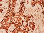 Cytokeratin 10 Polyclonal Antibody