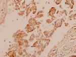 Cytokeratin 15 Polyclonal Antibody