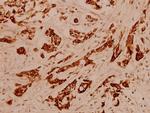 Cytokeratin 16 Polyclonal Antibody