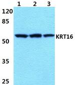 Cytokeratin 16 Antibody in Western Blot (WB)