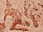 Cytokeratin 18 Polyclonal Antibody